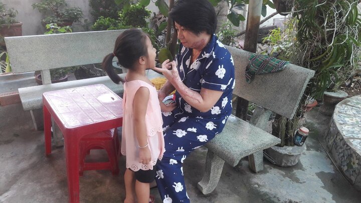 Người vợ bị chồng đốt đón Tết bình yên bên con gái