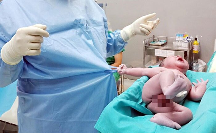 Bức ảnh bé trai chào đời níu áo bác sĩ không buông 'gây sốt' cộng đồng mạng