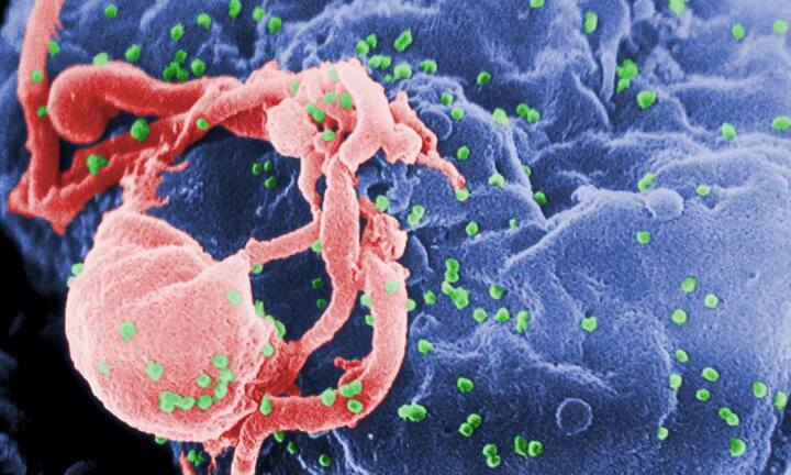 Người trưởng thành thứ ba chữa khỏi HIV