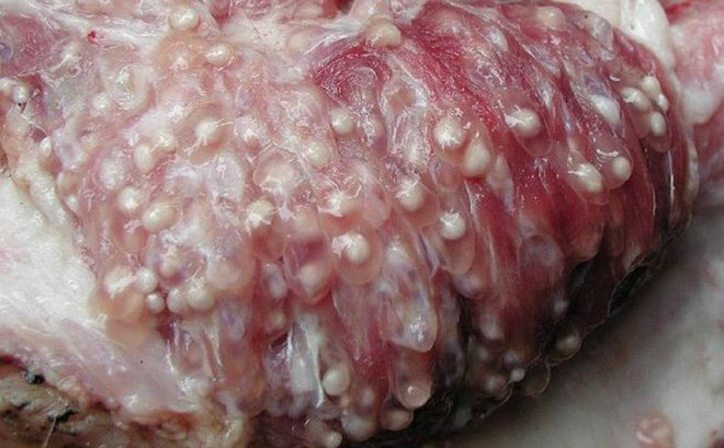 Cận cảnh thịt lợn nhiễm sán trường mầm non ở Bắc Ninh cho trẻ ăn và cách nhận biết