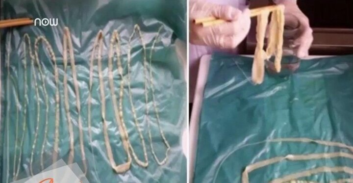 Nguyên tắc 'sống còn' trong ăn uống để không mắc sán lợn