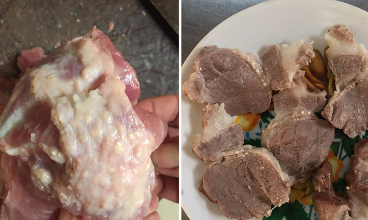 Video: 4 sự thật cần biết về bệnh sán lợn