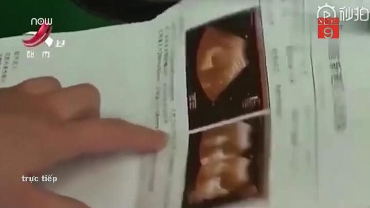 Bác sỹ kê nhầm thuốc bổ thành thuốc phá thai, thai phụ đau đớn mất con