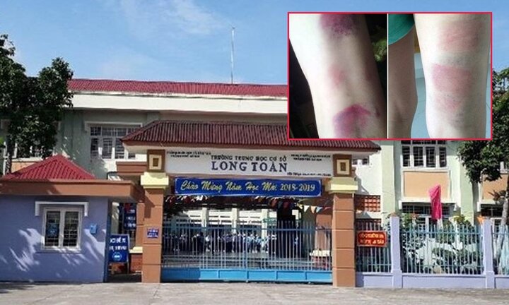 Tạm đình chỉ cô giáo bị tố đánh bầm tím chân 22 học sinh ở Bà Rịa – Vũng Tàu