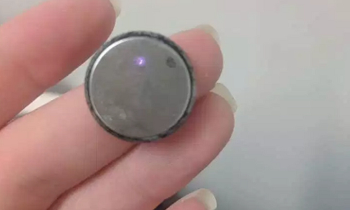 Nuốt cả viên pin, bé gái 5 tuổi nguy kịch