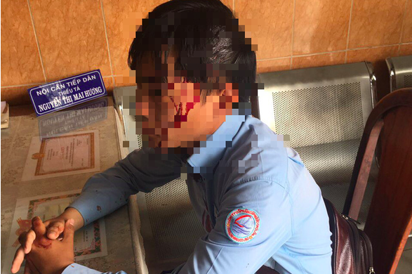 Bị chó cắn khi đi lấy số nước, nam nhân viên còn bị đánh vỡ đầu