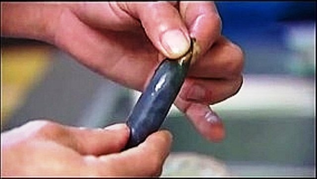 Nuốt mật cá trắm sống, người đàn ông nguy kịch