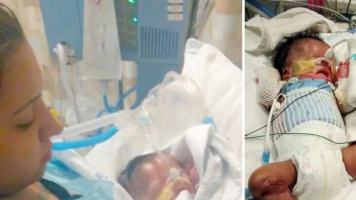 Video: Bác sỹ chạy đua với thời gian cứu bé sơ sinh không có da