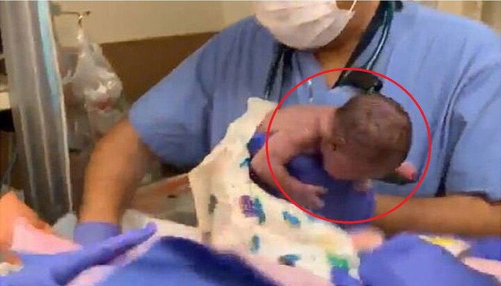 Clip: Bác sỹ tuột tay đánh rơi bé gái sinh non, nghi khiến bé xuất huyết não