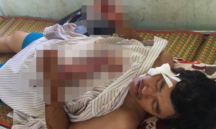 Bắt kẻ khai thác cát trái phép, chém xã đội trưởng trọng thương ở Bình Thuận