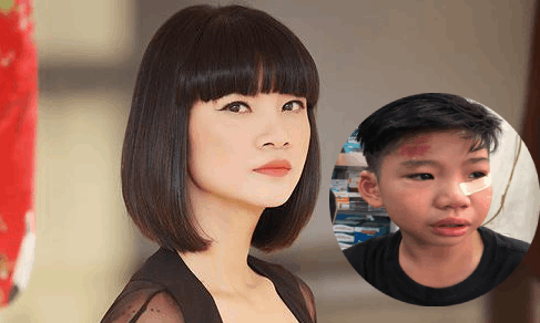 Con trai siêu mẫu Hạ Vy bị ô tô tông chấn động não rồi bỏ đi