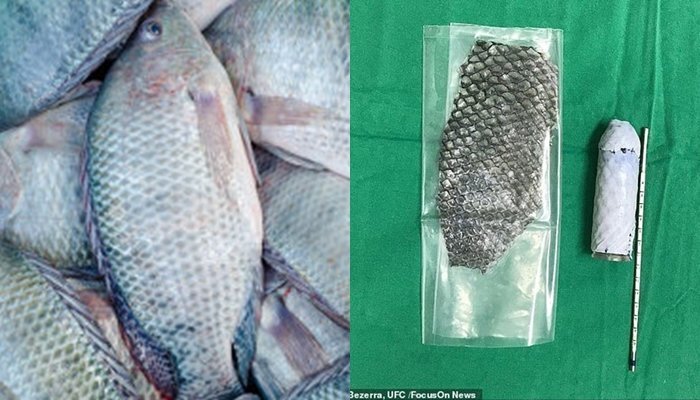 Bác sĩ lấy da cá rô phi để tạo hình 'vùng kín' cho một phụ nữ