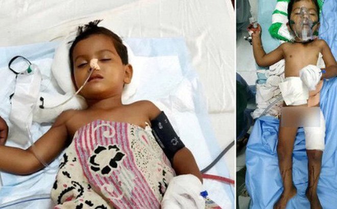 Bé trai sống sót thần kỳ sau khi ngã từ tầng cao và bị cây sắt xuyên qua người