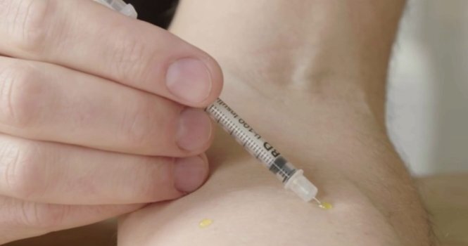 'Dị nhân' tự tiêm nọc độc rắn vào cơ thể suốt 28 năm vẫn không chết