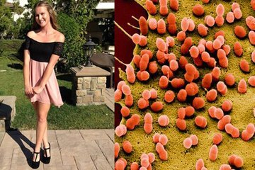 Nữ sinh 18 tuổi thiệt mạng sau một ngày đau đầu