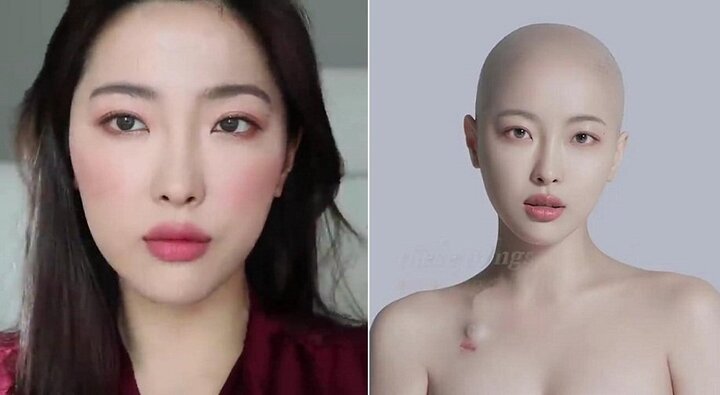 Video: Nhật ký chiến đấu với ung thư của cô gái xinh đẹp lay động triệu trái tim