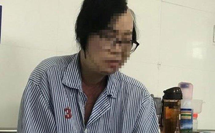 Cô giáo xinh đẹp bị chồng cũ tạt axit: 'Tôi từng sống không bằng chết'