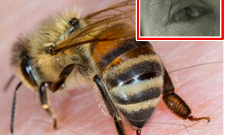 Người đàn ông 51 tuổi ở Quảng Nam suýt mù do bị ong đốt