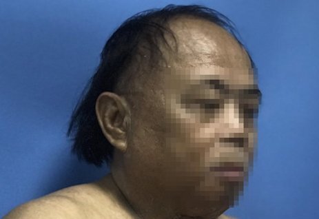 Nghe lời thầy bói, vợ tạt axit chồng để trục vong