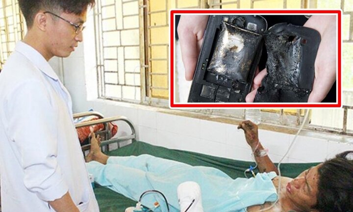 Điện thoại nổ khi đang sạc, thanh niên 22 tuổi ở Đồng Nai mất bàn tay