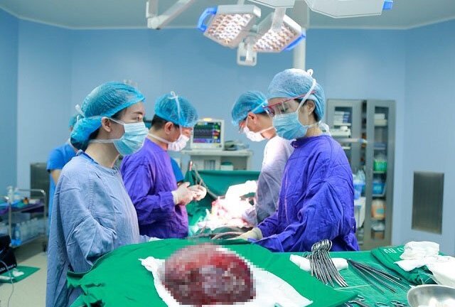 Bác sĩ bệnh viện 108 cắt bỏ thành công khối u khổng lồ chưa từng có
