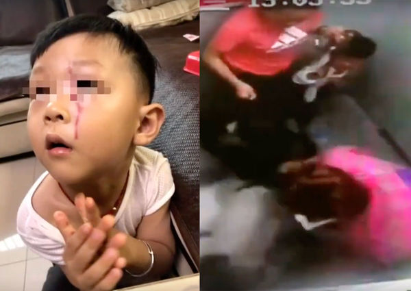 Bé trai bị chó khổng lồ tấn công trong thang máy