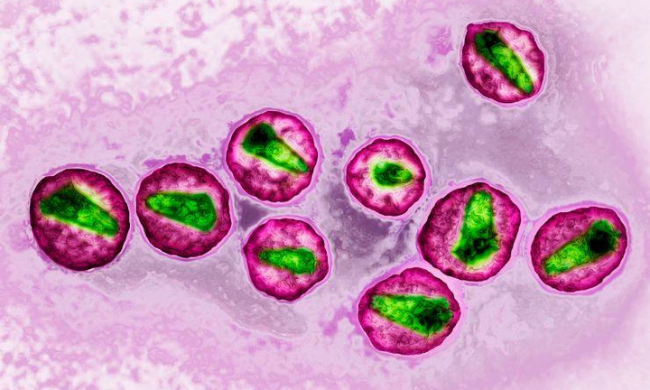 Giới khoa học đang ở rất gần cách chữa căn bệnh thế kỷ HIV/AIDS