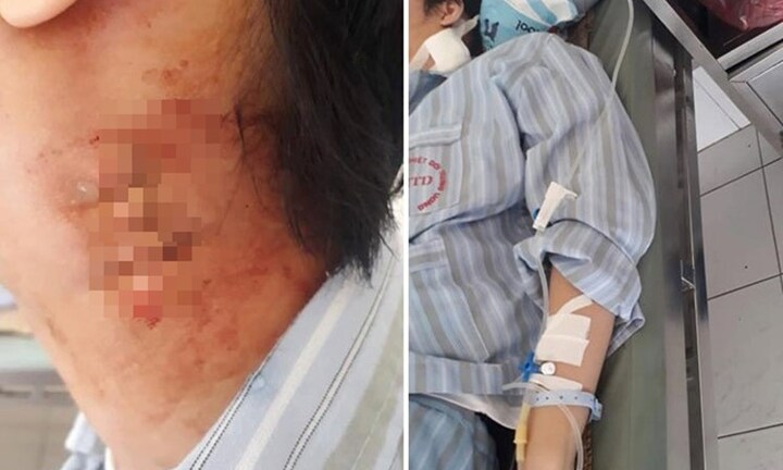 Nghi vấn Bệnh viện Nhiệt đới Trung ương, Bạch Mai chẩn đoán sai, mổ nhầm cho bệnh nhân