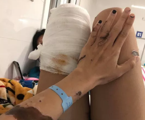 Thiếu úy công an tạt axit vợ sắp cưới chuẩn bị hầu tòa 