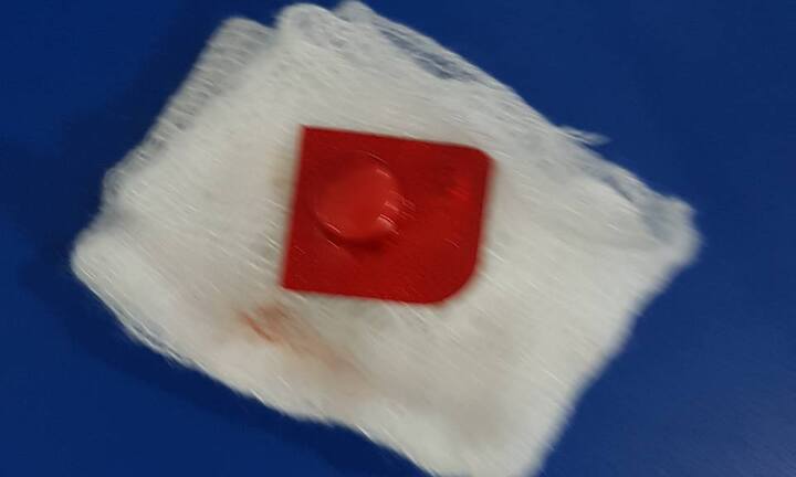 Cụ bà 76 tuổi uống thuốc nuốt luôn cả vỏ phải nhập viện cấp cứu