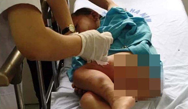 3 trẻ bị bỏng nặng do cô giáo đốt cồn dạy học: Tạm đình chỉ cơ sở mầm non