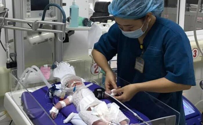 Cứu sống bé sơ sinh bị ngạt khí trong bụng người mẹ đã qua đời