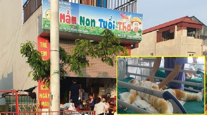 Cô giáo đốt cồn làm 3 trẻ mầm non bị bỏng có thể bị xử lý hình sự