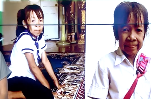 Video: Bé gái Campuchia 10 tuổi già như bà lão 60