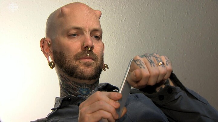 Người đàn ông cấy chip điện tử vào cơ thể