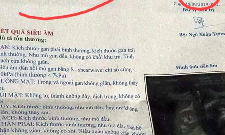 Vợ giật mình khi chồng đi siêu âm về có 'tử cung, buồng trứng'