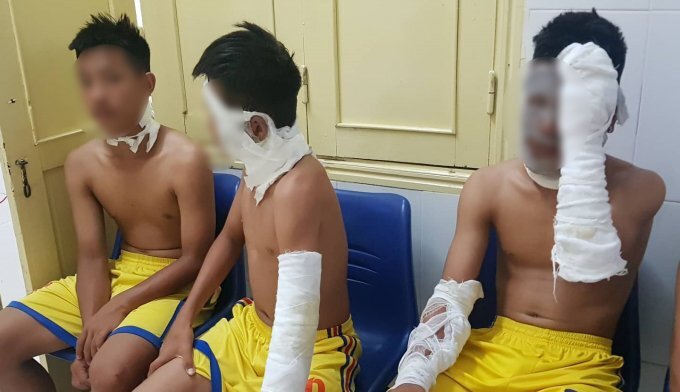 Bóng bay phát nổ trên sân, 3 cầu thủ U14 Sông Lam Nghệ An nhập viện