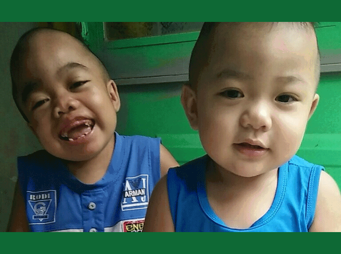 Hành trình đầy nước mắt của người mẹ chạy chữa cho hai con nhỏ mắc bệnh y học 'bó tay'