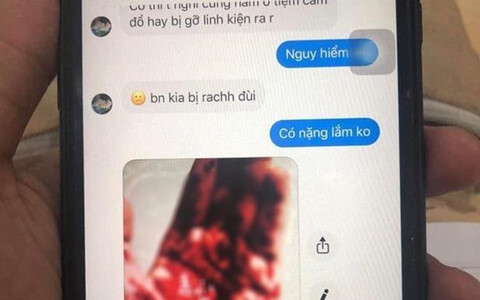 Hai sinh viên bị cướp, rạch đùi: Đại học Quốc tế TP.HCM lên tiếng