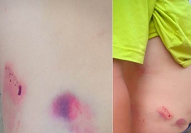 Chánh văn phòng huyện ủy giải thích lý do đánh tài xế nhập viện