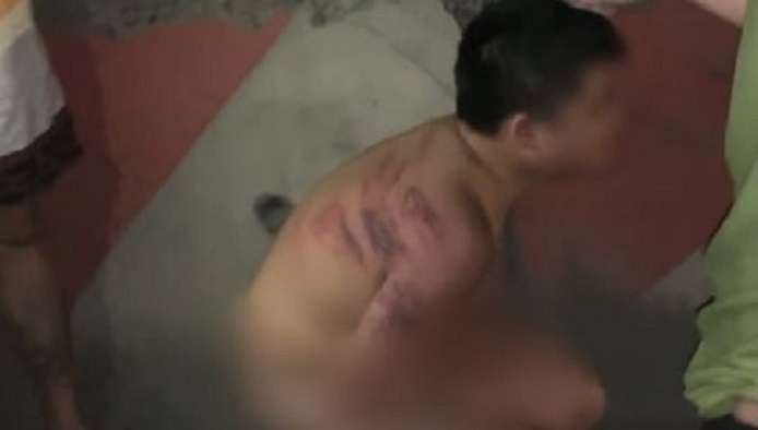 Mẹ đánh con bầm tím, bắt cởi quần áo quỳ ở vỉa hè