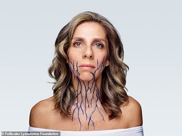 Nữ phó chủ tịch Facebook mắc bệnh ung thư máu