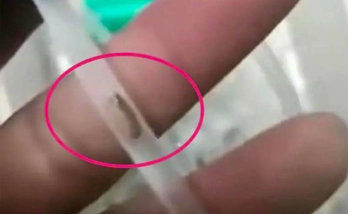 Bé 3 tuổi bị nhiễm trùng vì ống truyền dịch có 'giun', bệnh viện xin lỗi