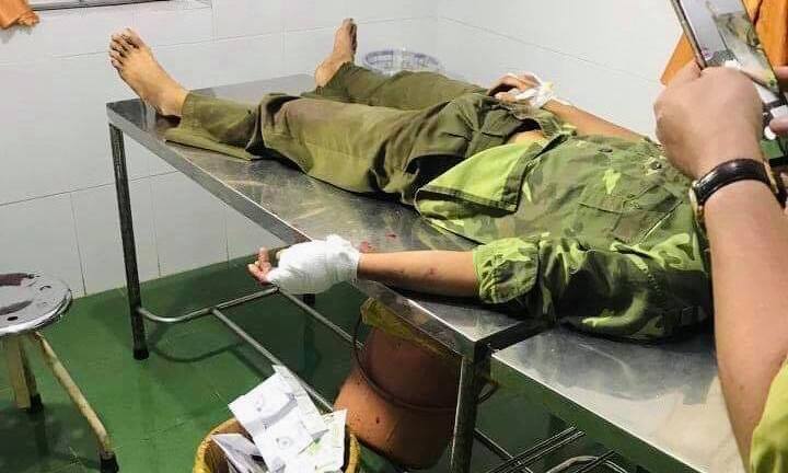 Lâm tặc chém trọng thương kiểm lâm Vườn quốc gia Yok Đôn