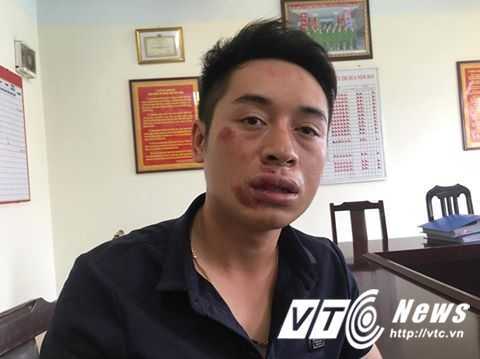 Bị yêu cầu dừng xe, nam thanh niên đấm gãy răng CSGT