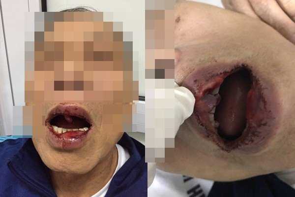 Cán bộ Sở Ngoại vụ Hà Nội đánh tiến sĩ 76 tuổi nhập viện đang 'nghỉ phép'