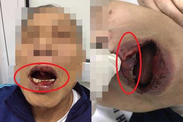 Cách chức cán bộ Sở Ngoại vụ hành hung tiến sĩ 76 tuổi