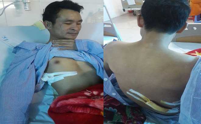 Cứu người gặp nạn, người đàn ông bị đâm gục tại chỗ