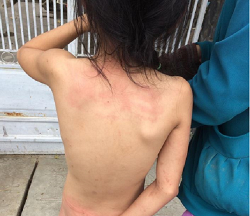 Bé gái bị đánh, trần truồng đứng giữa đường gây phẫn nộ