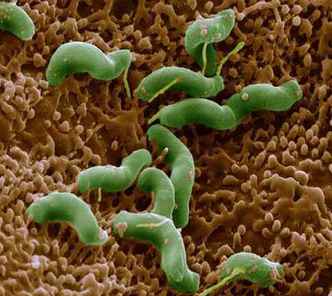 Những người bị dạ dày nên biết 6 điều về vi khuẩn Hp